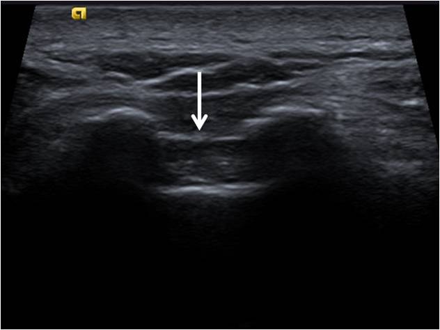 Schmerzsprechstunde Lindenhofgruppe Lindenhofgruppe AG
